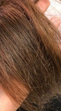 Antes