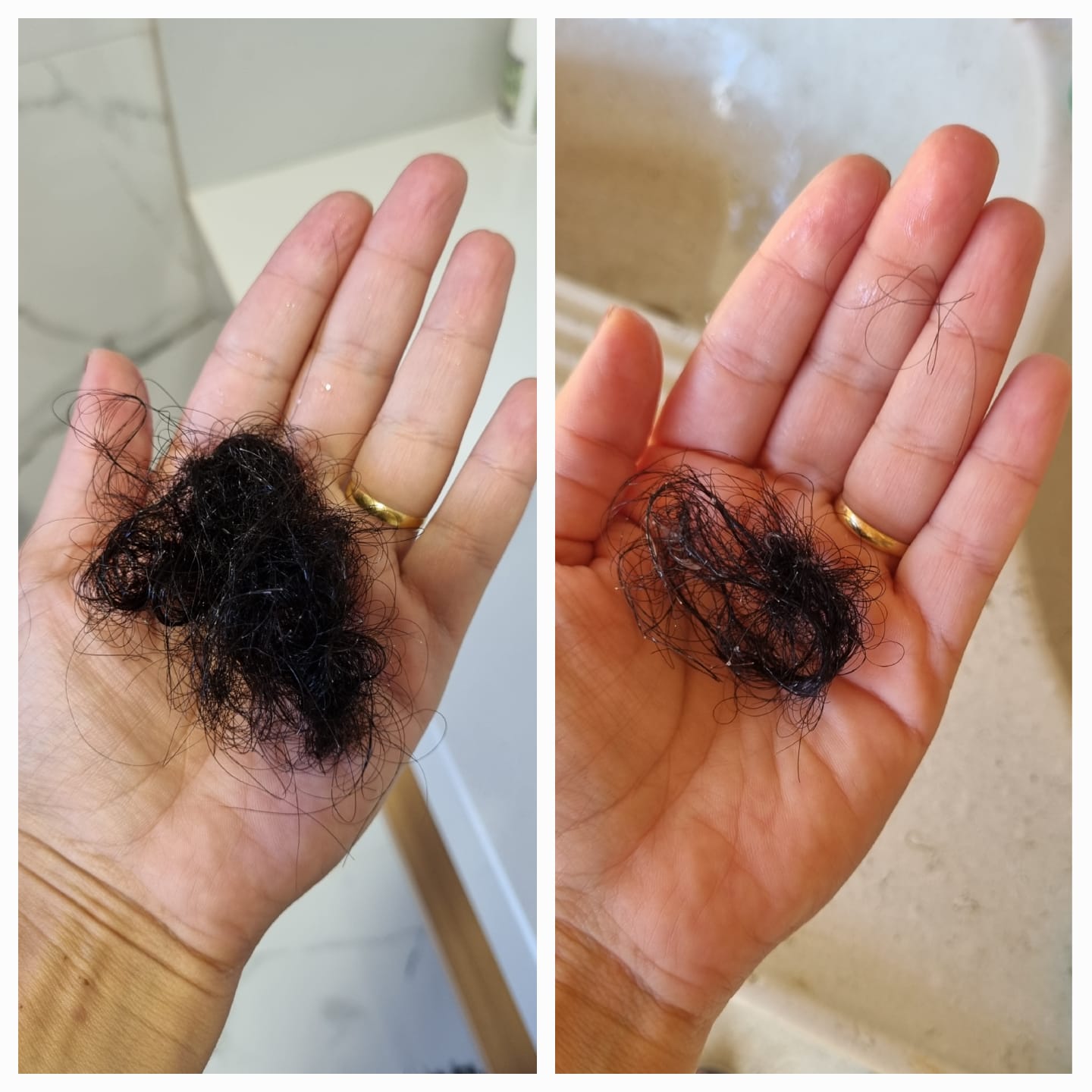 Antes e Depois — Redução da queda