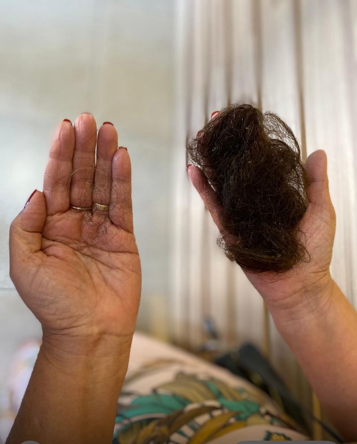 Antes e Depois — Juliana R.