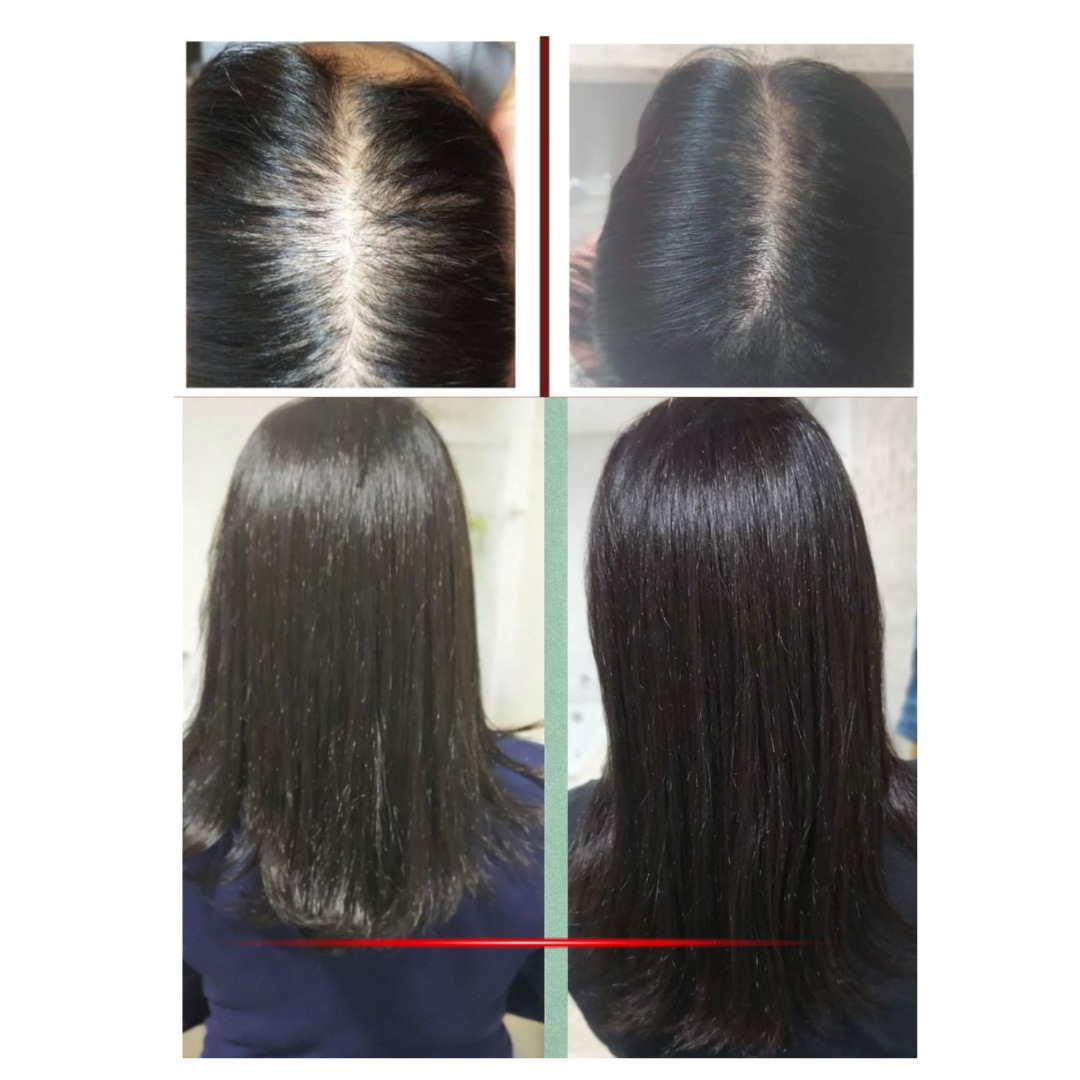 Berenice — Antes e Depois do Tratamento